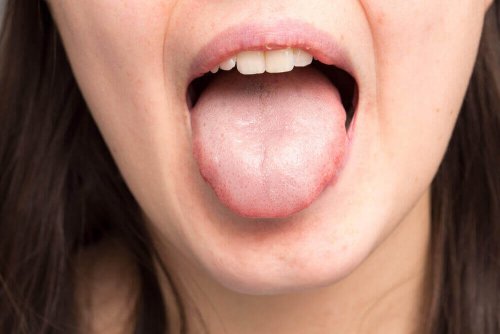 Kvinde med tungen ud af munden viser tykt spyt