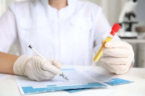 Læge tjekker urinprøver for lavt kreatinintal