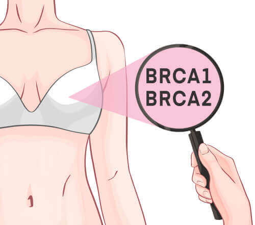 BRCA-1 og BRCA-2 generne og brystkræft