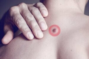 Årsagen til fedtknuder på ryggen