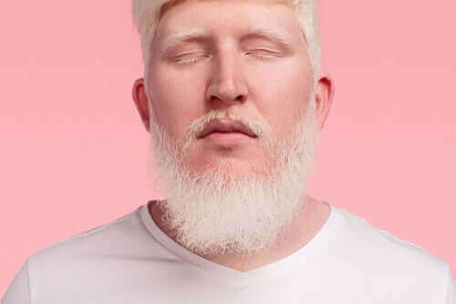 Mand med albinisme foran lyserød baggrund