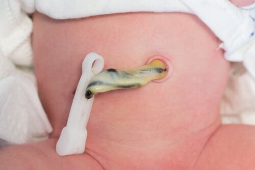 En nyfødt babys navle