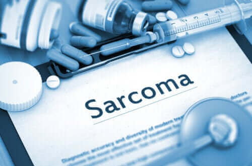 Sarkomer: Karaktertræk og årsager