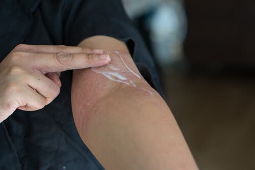 Person kommer creme på indersiden af albue