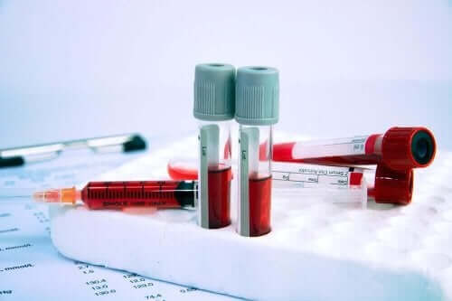 Blodprøver kan hjælpe med at afgøre lægemidler til at behandle anæmi