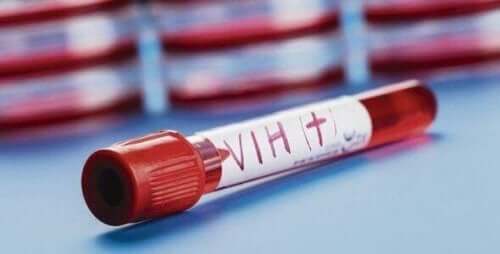 Blodprøve med HIV