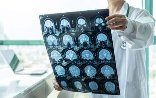 Læge med scanninger af hjerne