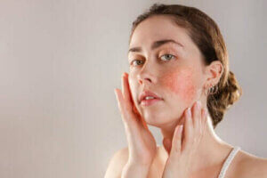 Reaktiv hud: Symptomer, årsager og behandling