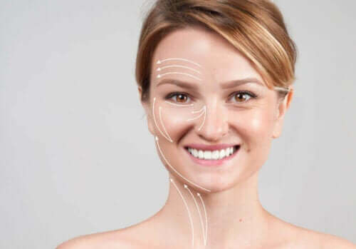 Rynker i kvindes ansigt kan forbedres med soft lift