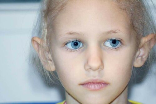 Pige med retinoblastom