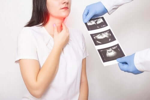 Symptomer og behandling af skjoldbruskkirtelkræft