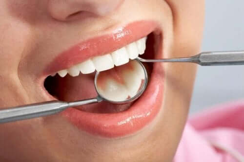 Kvinde får lavet tandlægetjek