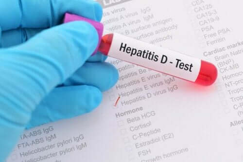 Test af hepatitis D