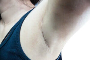 Hvad er skildvagtslymfeknuderne?