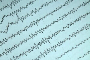 Sådan kan man håndtere epilepsi og amning