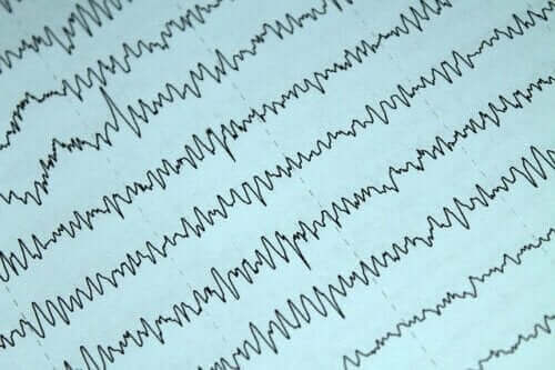 Sådan kan man håndtere epilepsi og amning