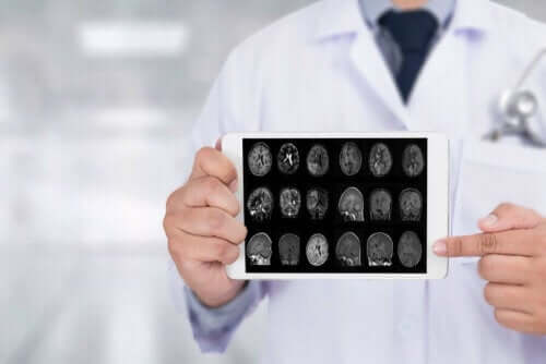 Læge med scanninger af hjerne