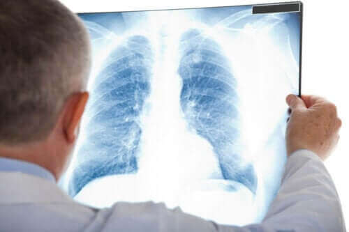 Hvad er kold lungebetændelse?
