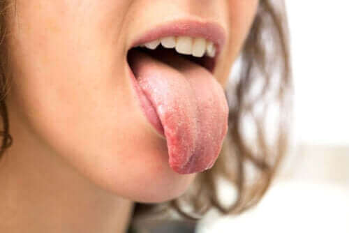 Derfor kan personer med diabetes opleve tør mund