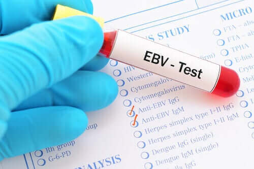 Test af Epstein-Barr virus