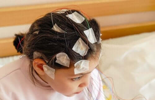 Pige med elektroder på hoved bliver tjekket for epilepsi i barndommen