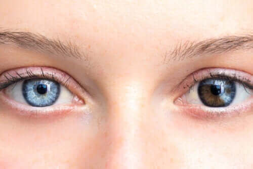 Ændringer i øjenfarve kan være grund til bekymring
