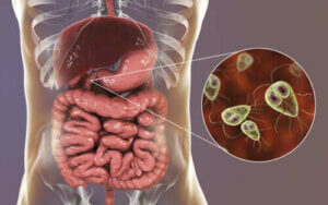 Symptomer og behandling af giardiasis