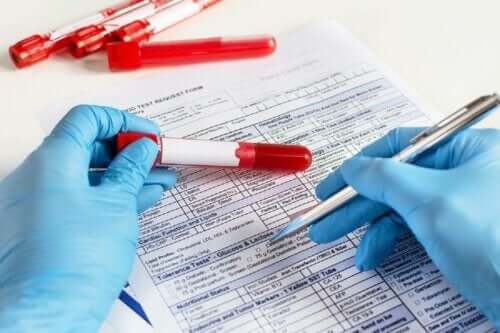 Blodprøve analyseres for at tjekke for hæmofili hos kvinder
