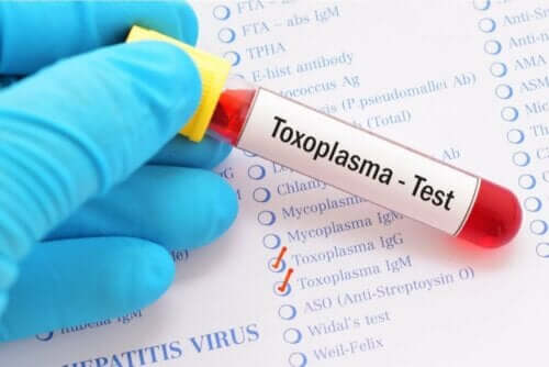 Blodprøve for toxoplasma