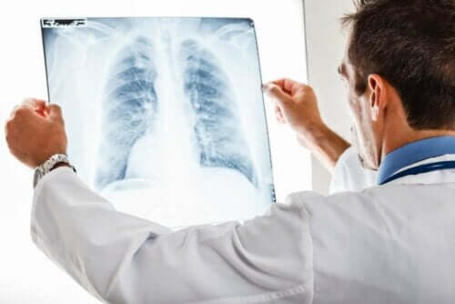 Røngtenbilleder kan afsløre bronkitis