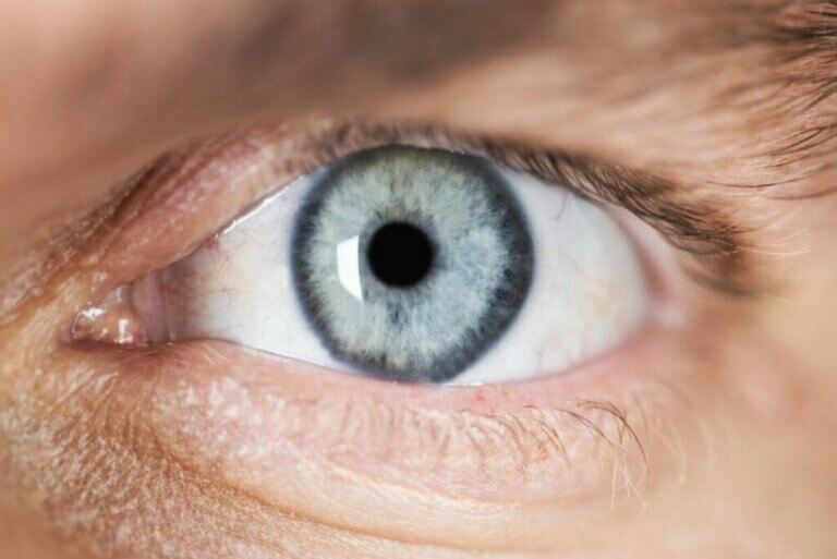 Beskrivelse og årsager til miosis (pinpoint pupiller)