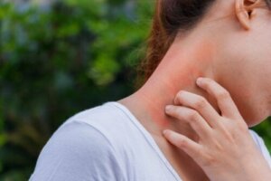 Forbindelsen mellem dermatitis og kortikosteroider