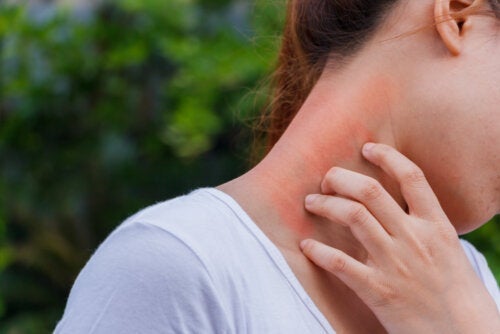 Forbindelsen mellem dermatitis og kortikosteroider
