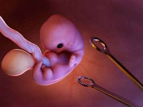 Provokeret abort: Hvad indebærer det?