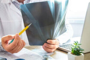 Knoglemarvsødem: Alt, hvad du bør vide