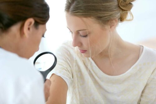 Kvinde får undersøgt godartede hudsvulster