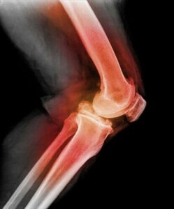 Artroskopi ved ledskader