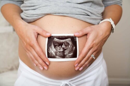Gravid kvinde med scanningsbillede på sin mave