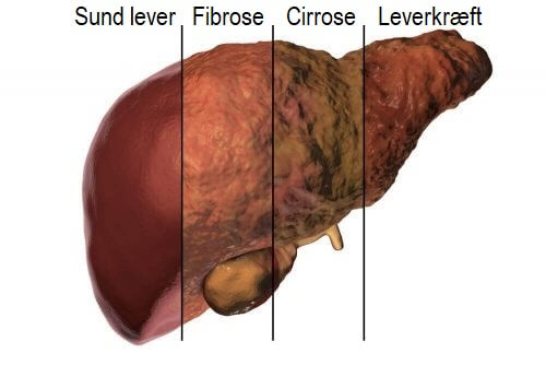 Illustration af leveren og levermetabolisme