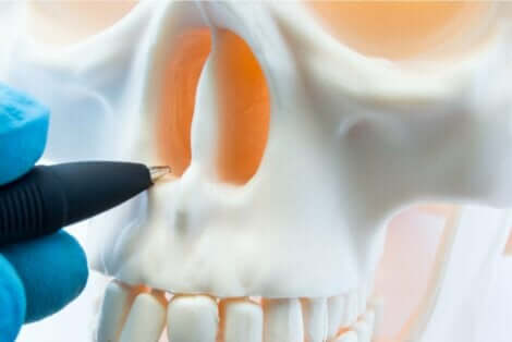 Illustration af nasal septumperforation i næsehuler