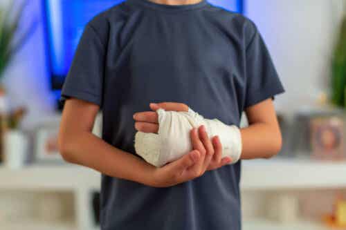 Barn med den ene hånd i gips