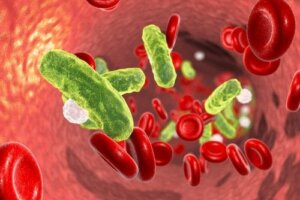 Urinvejssepsis: Årsager og behandlinger