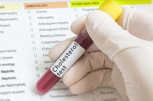 Blodprøve, der tjekker for kolesterol