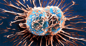 Hvorledes immunsystemet kan bekæmpe kræft