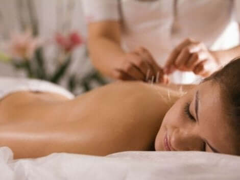 Akupunktur lader til at hjælpe nogle patienter