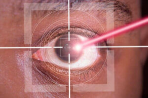 Fordele og ulemper ved LASIK behandling