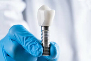 Årsager, symptomer og forebyggelse af periimplantitis