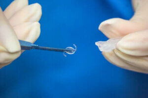 Intraokulær linseoperation: Hvornår er det nødvendigt?