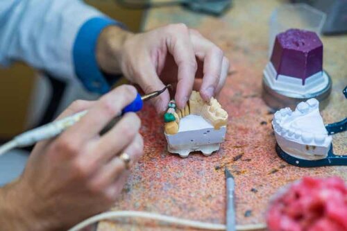 Tandlæge laver tandbroer