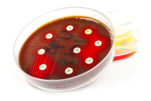 Hvad er anvendelsesområderne for et antibiogram?